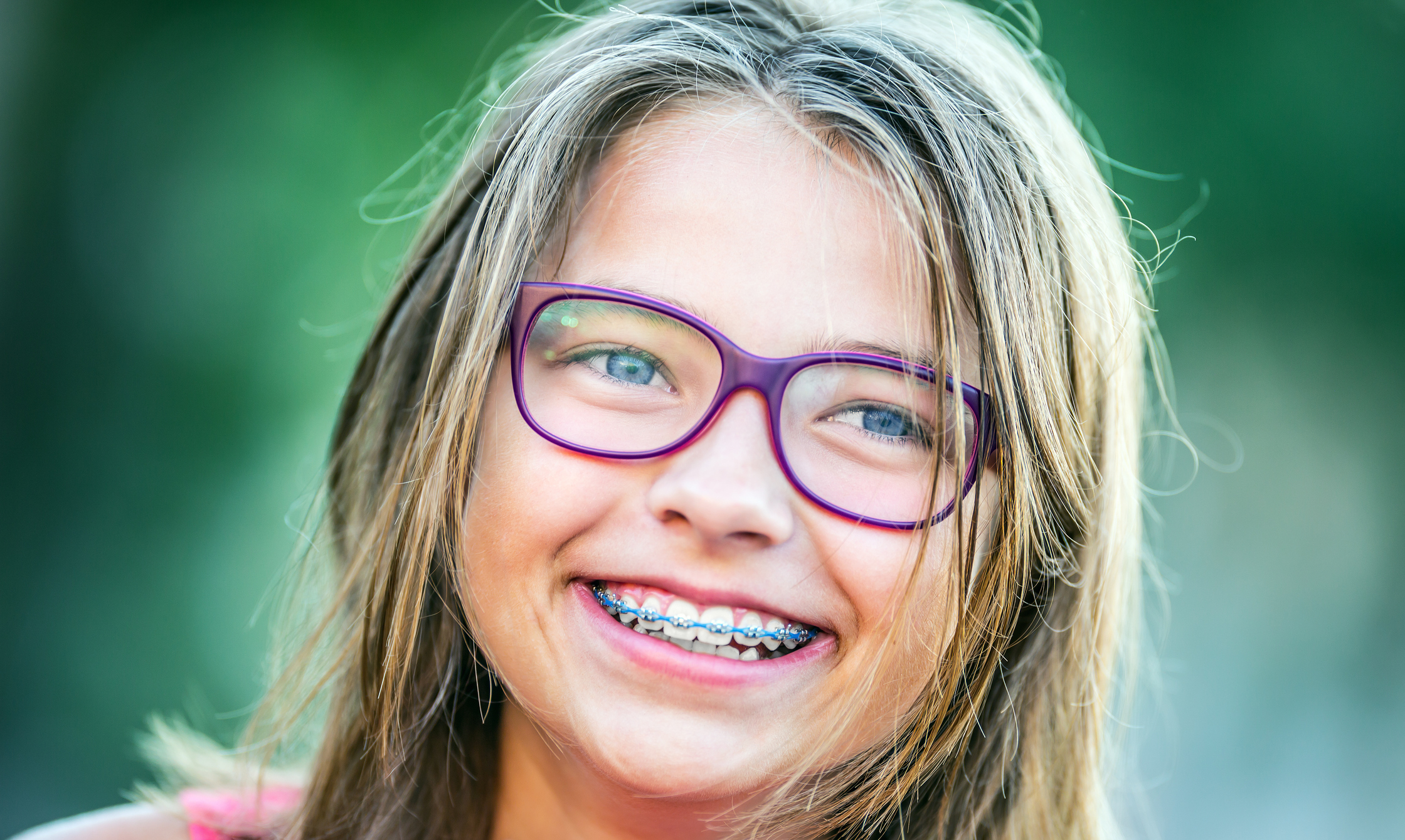 How do I know if my child needs braces?
